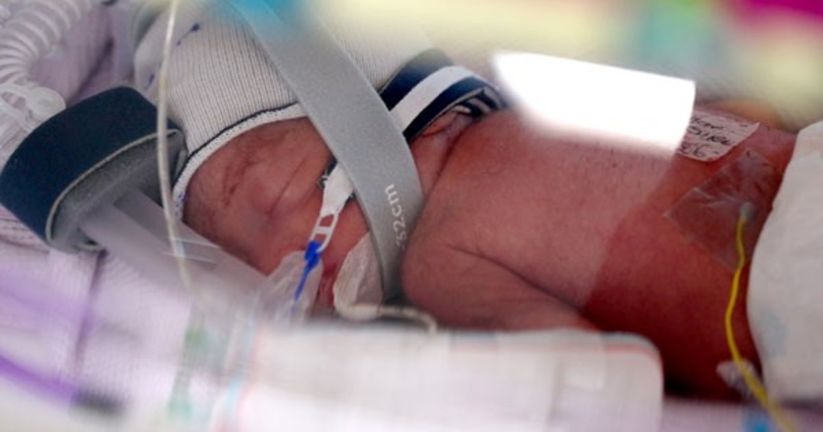 Nacen cuatrillizas idénticas en Australia: un caso sin precedentes