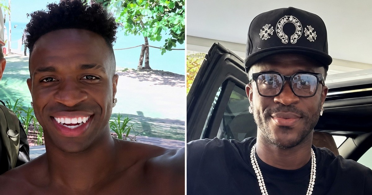 Vinicius Jr sorprende con cambio facial tras el Mundial: se sometió a una armonización de mentón
